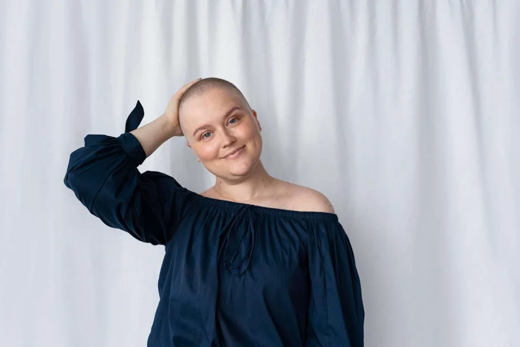 What causes chemotherapy hair loss?