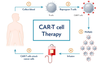 CAR T-Cell Therapy: A New Hope in Cancer Treatment